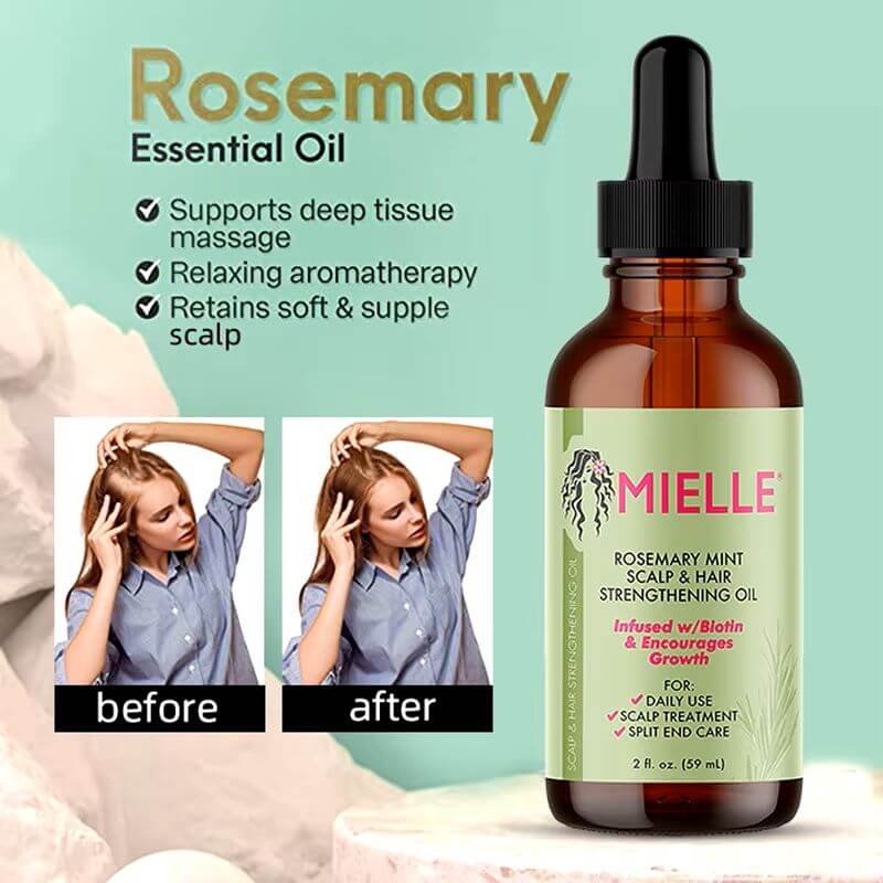 rosemary hair oil - advantages