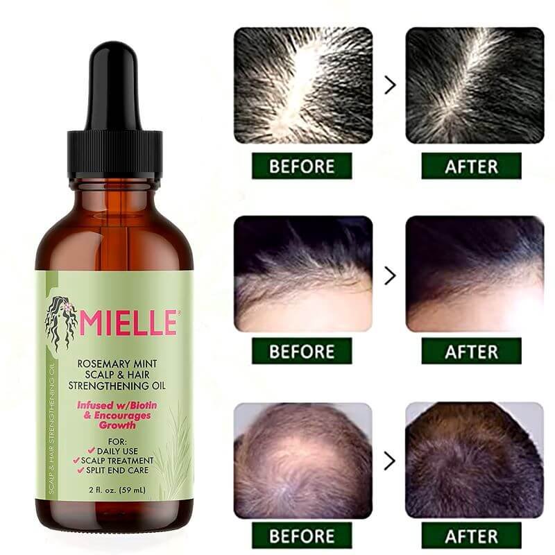 rosemary hair oil - customers testimonials before and after use