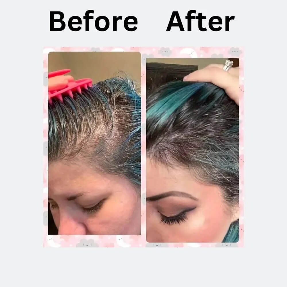 rosemary hair oil - female customer hair growth before and after use