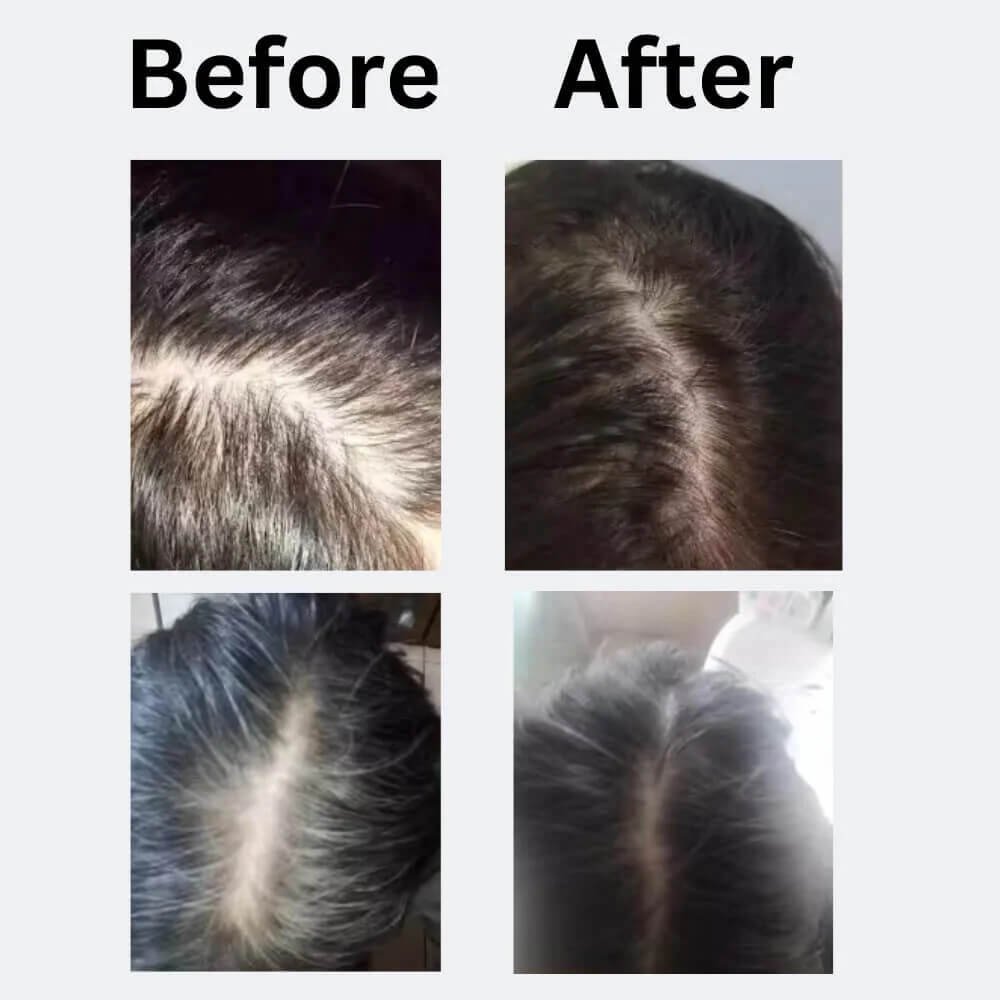 rosemary hair oil - female customers before and after use