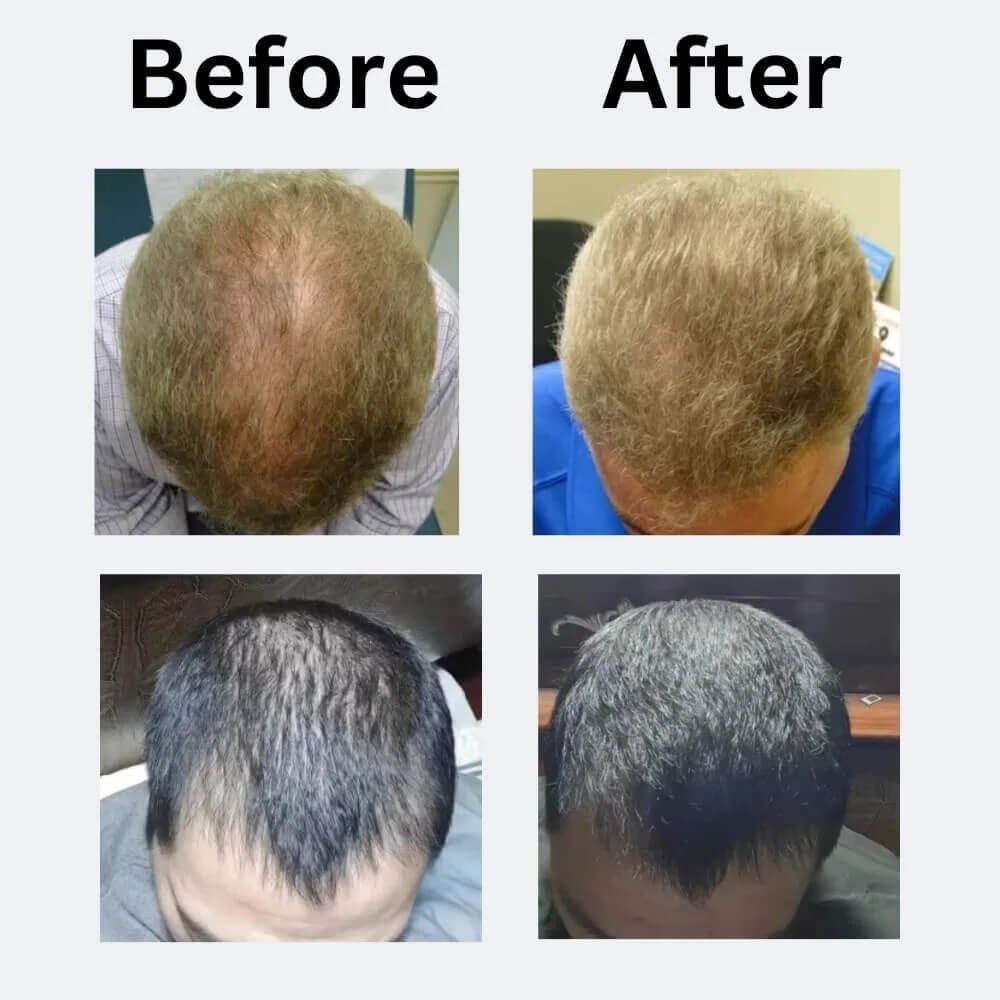 rosemary hair oil - male customers before and after use