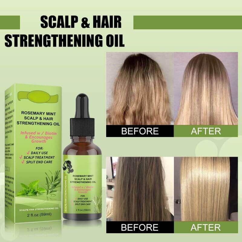 rosemary hair oil-scalp and hair strenghtening oil